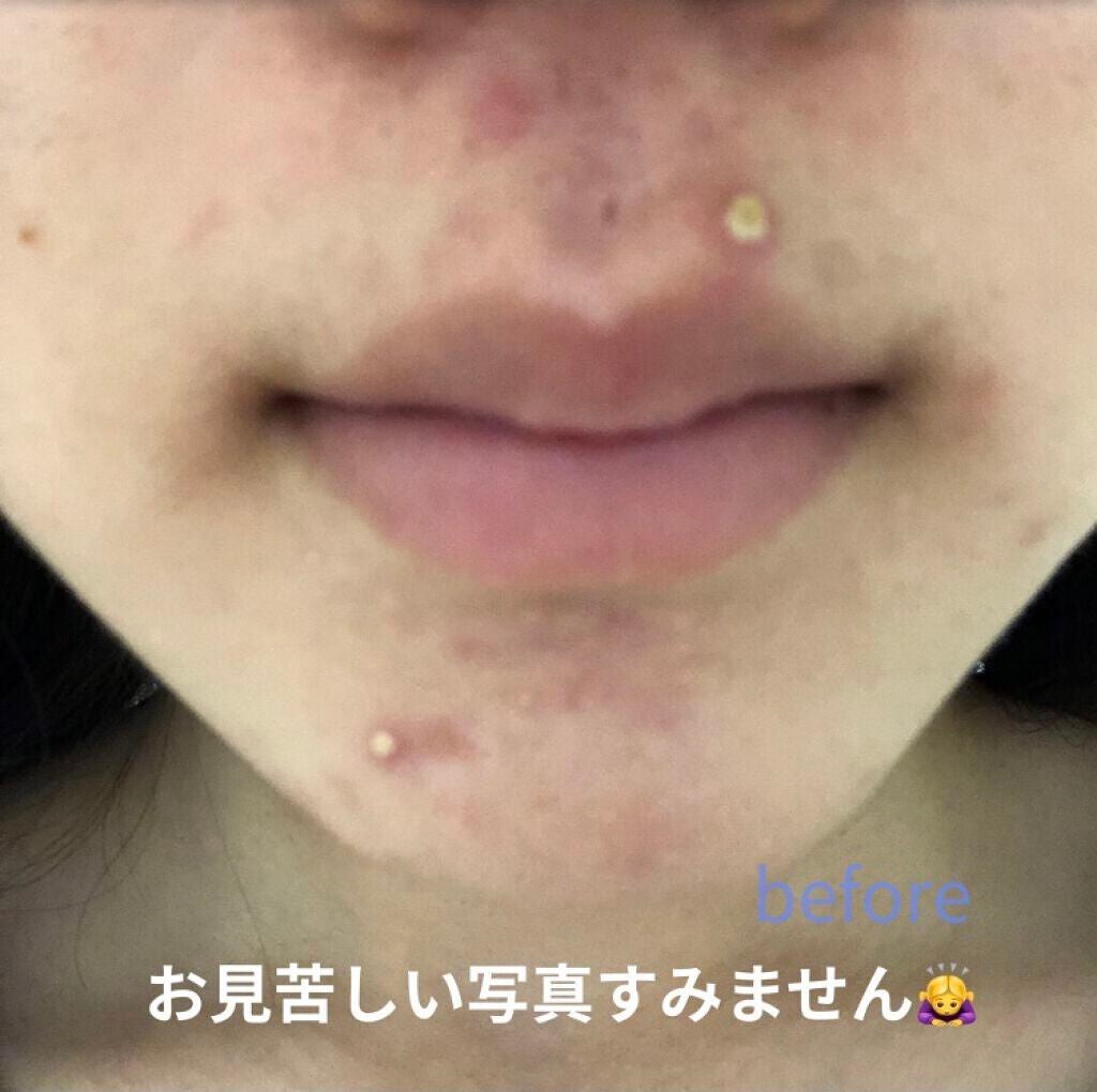 ハトムギ化粧水(ナチュリエ スキンコンディショナー R )/ナチュリエ/化粧水を使ったクチコミ(3枚目)