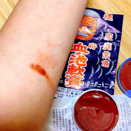 血の池軟膏(医薬品)/血の池地獄/その他を使ったクチコミ(3枚目)