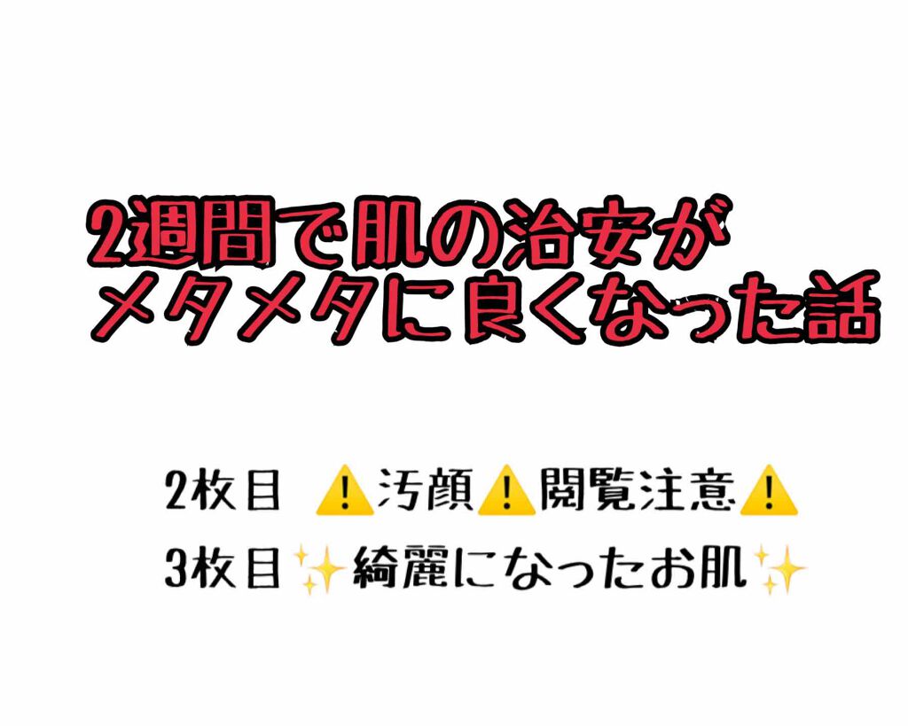 アルビオン 薬用スキンコンディショナー エッセンシャル/ALBION/化粧水を使ったクチコミ(1枚目)