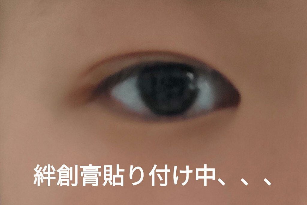 絆創膏/DAISO/その他を使ったクチコミ(4枚目)