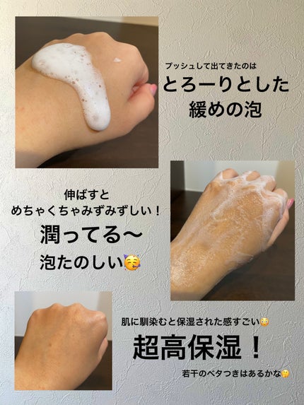 フェルゼアプレミアム 薬用泡の化粧水/フェルゼア/化粧水を使ったクチコミ(2枚目)