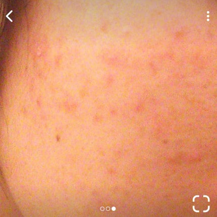 敏感肌用薬用美白美容液/無印良品/美容液を使ったクチコミ(2枚目)