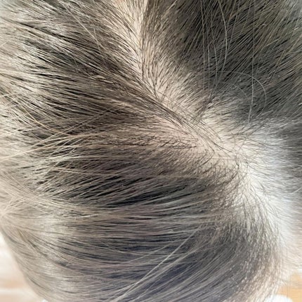 chichannnnð§žãã©ãã100 on LIPS ãâ
š̮ãã«ã¿ãã¢ããŒã·ã§ã³å¥³æ§ç¹æã®é«ªãé ç®ã®æ©ã¿ã«æ ¹æ¬åå ã..ãïŒ6æç®ïŒ