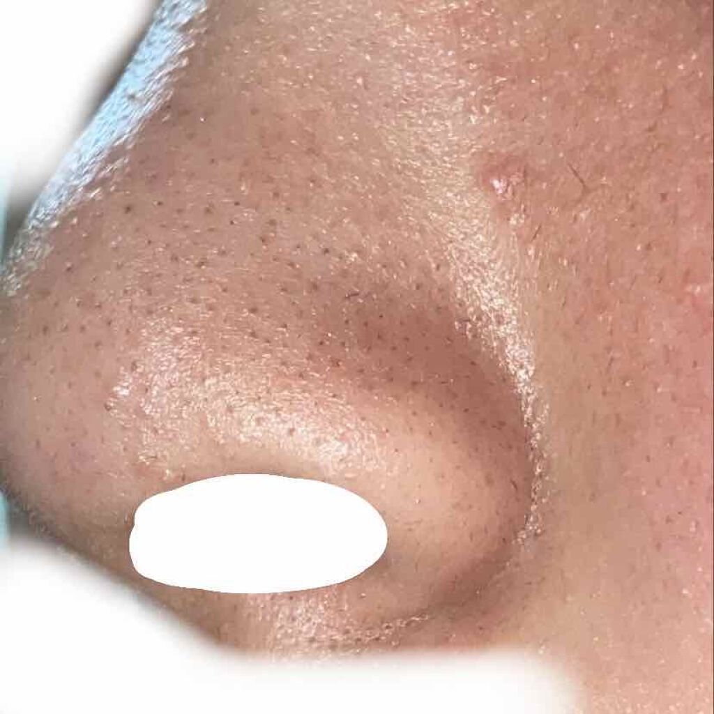 綿棒 PP軸 350本入り/DAISO/その他スキンケアグッズを使ったクチコミ（1枚目）