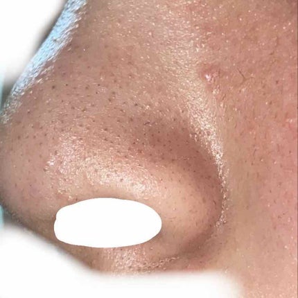 オリジナル ピュアスキンジェリー/ヴァセリン/ボディクリームを使ったクチコミ(1枚目)