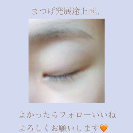 アイラッシュセラム〈まつげ美容液〉/DAISO/美容液を使ったクチコミ(3枚目)