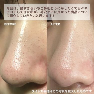 角栓ケア 話題沸騰中のコスメ 真似したいメイク方法の口コミが607件 デパコスからプチプラまで Lips