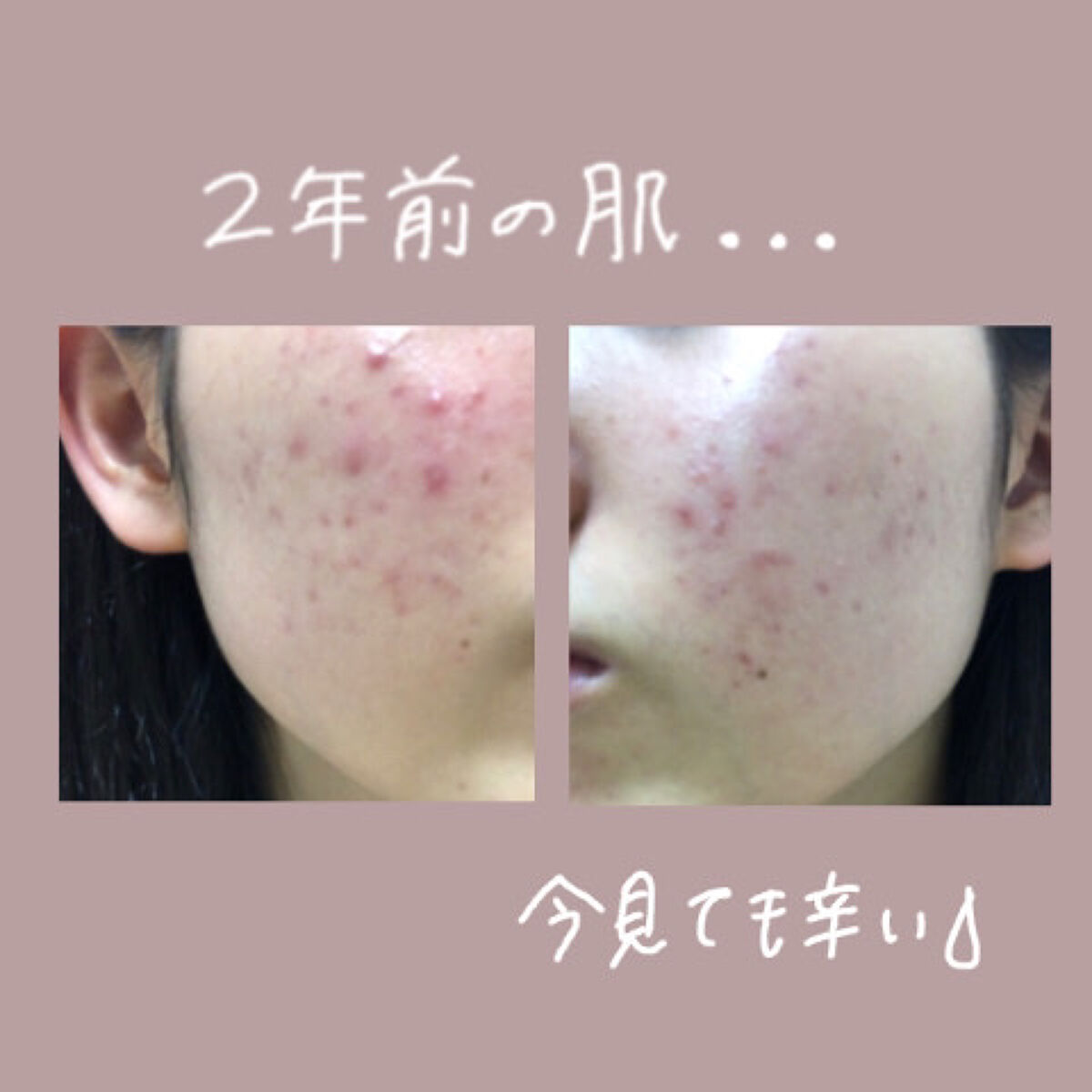 しっかりクリアジェル/ビオレ/クレンジングジェルを使ったクチコミ（2枚目）