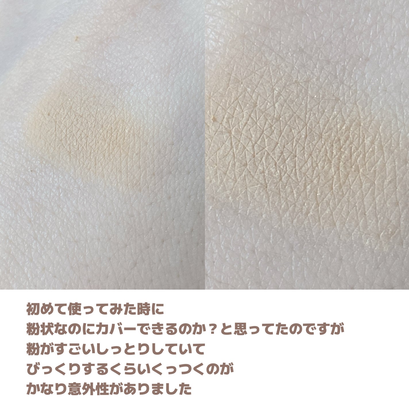 薬用コンシーラー アクネプロテクター/ONLY MINERALS/パウダーコンシーラーを使ったクチコミ(7枚目)