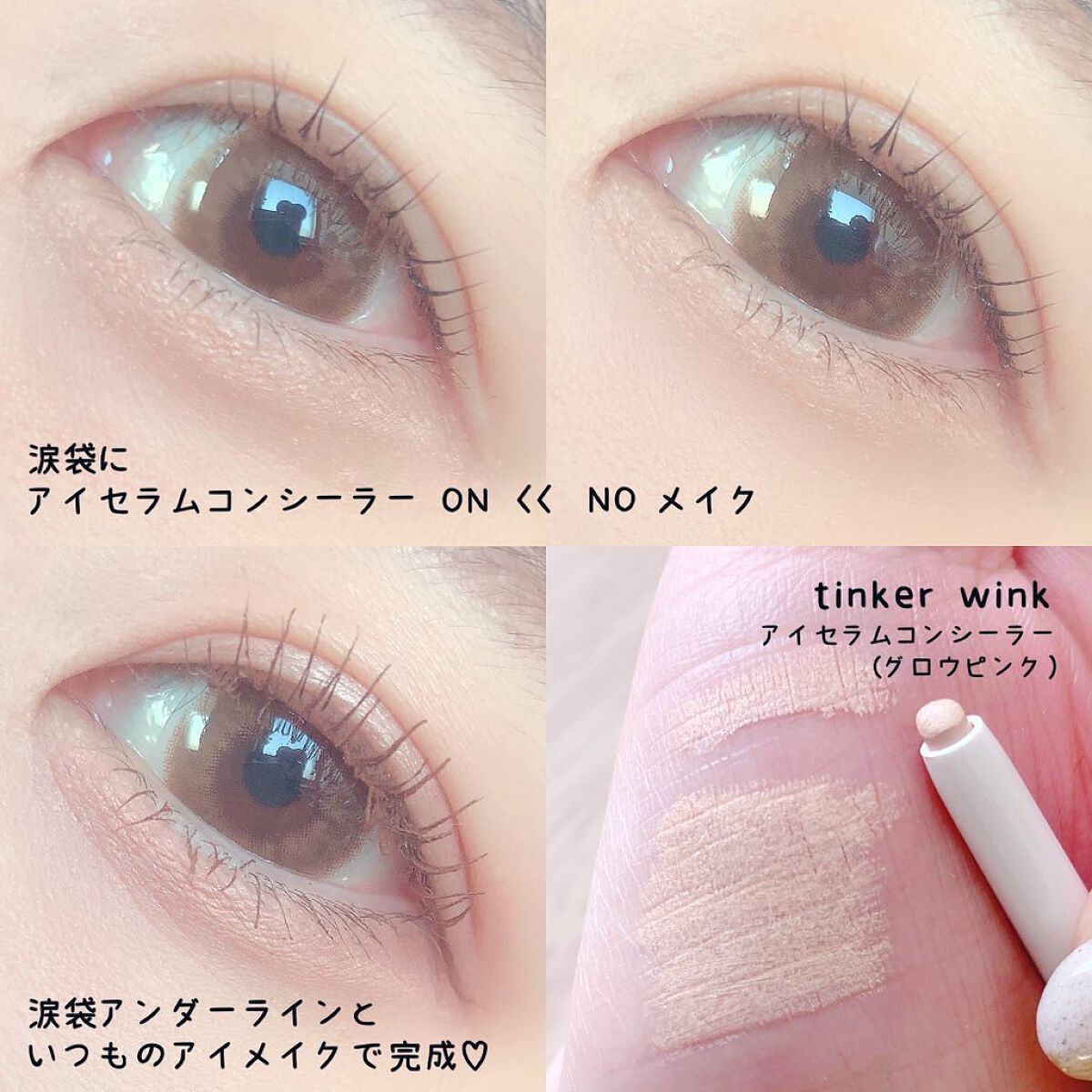 アイセラムコンシーラー/ティンカーウィンク/ペンシルコンシーラーを使ったクチコミ(2枚目)