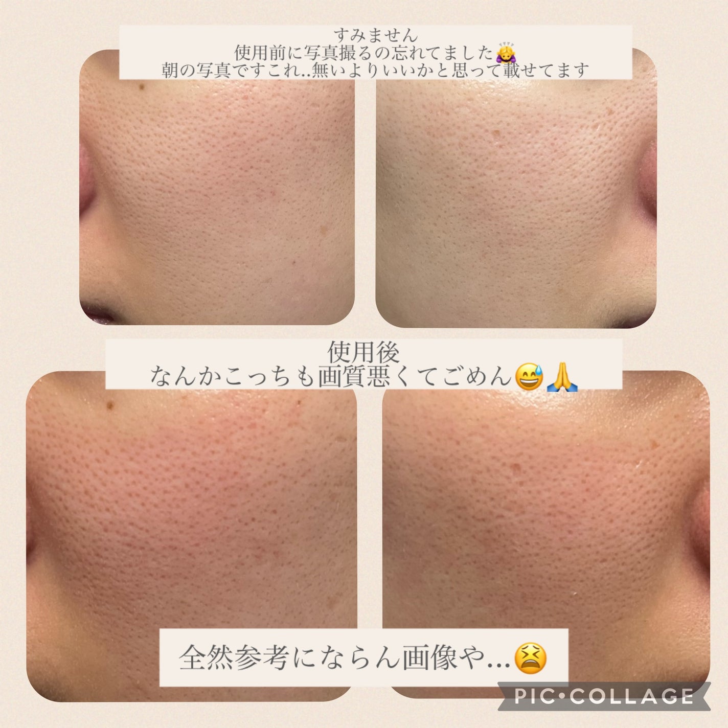 シカレチA マスク/VT/シートマスク・パックを使ったクチコミ(4枚目)