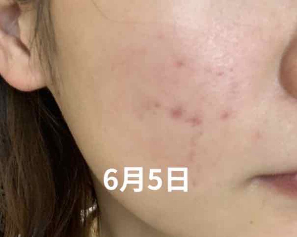 チョコラBBスパークリング/チョコラBB/美容ドリンクを使ったクチコミ(4枚目)