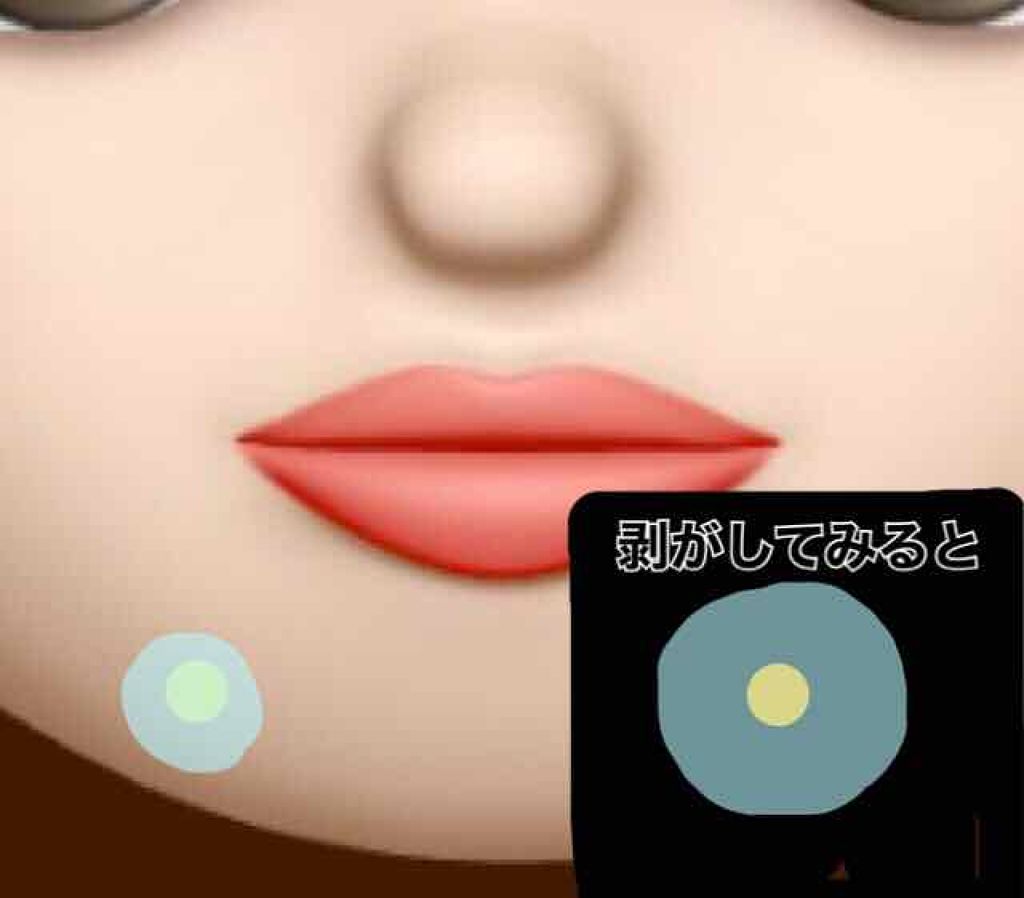 ACC パッチ/ETUDE/シートマスク・パックを使ったクチコミ(2枚目)