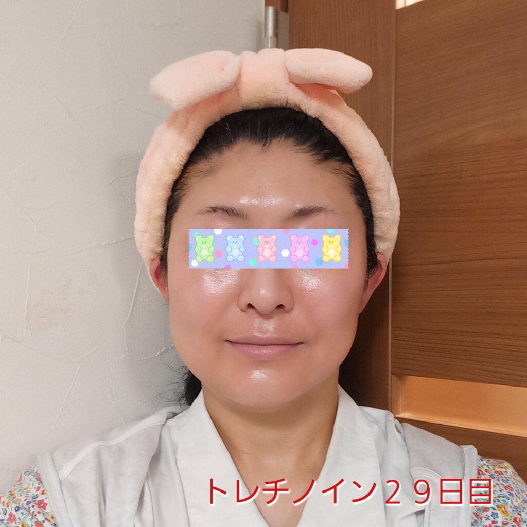 モイスチャーバーム ジャー/キュレル/フェイスクリームを使ったクチコミ（1枚目）