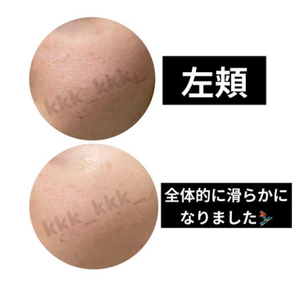 C25セラム ネオ/オバジ/美容液を使ったクチコミ(3枚目)