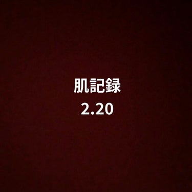 抗生物質(クラリシッド)貰って、かぶれも朝に治っては夜にまたかぶれての繰り返しだったので新たに軟膏入れて塗り薬調合してもらってで、顎の大きいニキビはちょっとずつ小さくなってきたかなと思う

でも、本当に