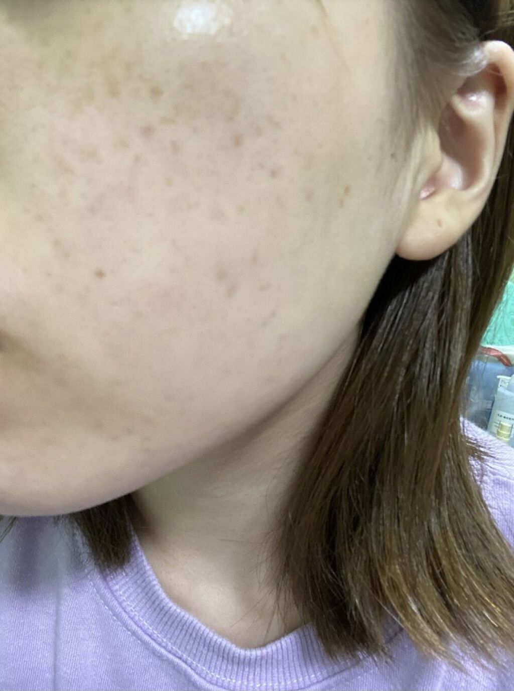 モイスチャー リッチローション(とてもしっとり)/アルージェ/化粧水を使ったクチコミ（3枚目）