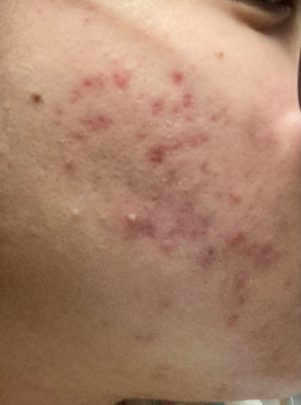 保湿クリーム /ちふれ/フェイスクリームを使ったクチコミ(2枚目)