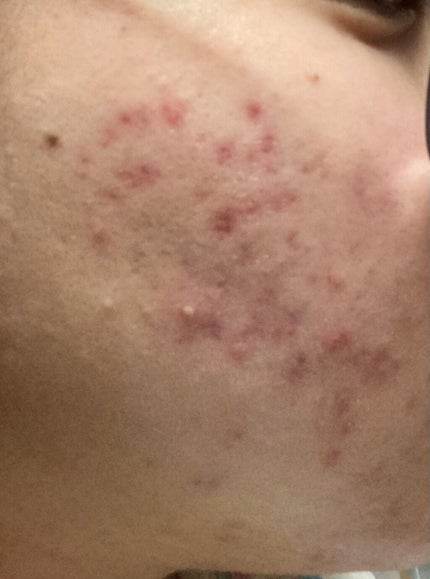 保湿クリーム /ちふれ/フェイスクリームを使ったクチコミ(2枚目)