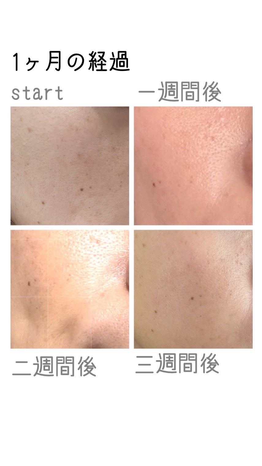 MiRAY/MYTREX/美顔器・マッサージを使ったクチコミ(2枚目)