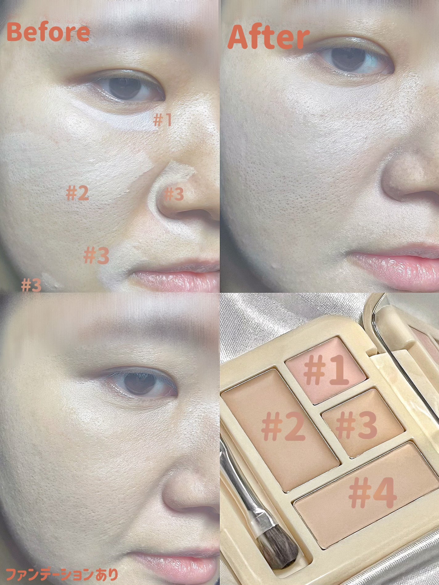 ダブルラスティング コンシーラーパレット/ETUDE/パレットコンシーラーを使ったクチコミ(5枚目)