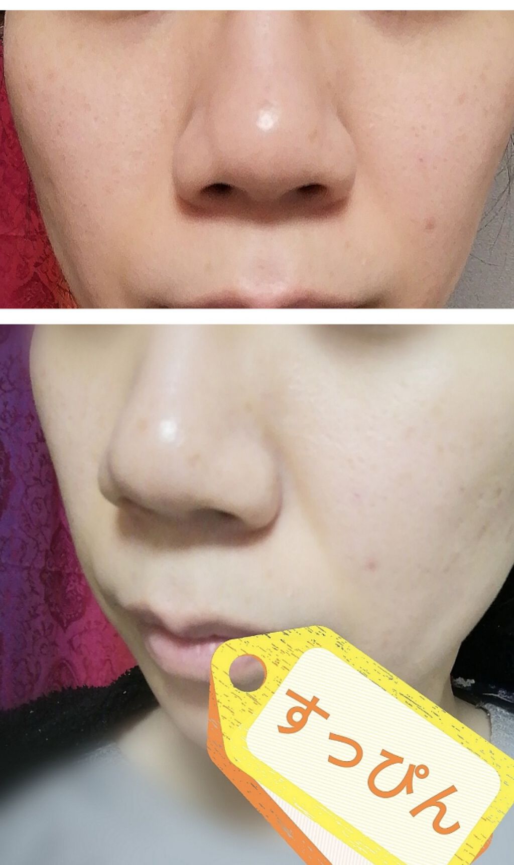 ドクタージャルト シカペア リカバー (第2世代）/Dr.Jart＋/フェイスクリームを使ったクチコミ（2枚目）