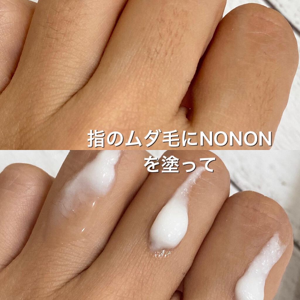 NONON/NONON(ノンノン)/除毛クリームを使ったクチコミ（2枚目）