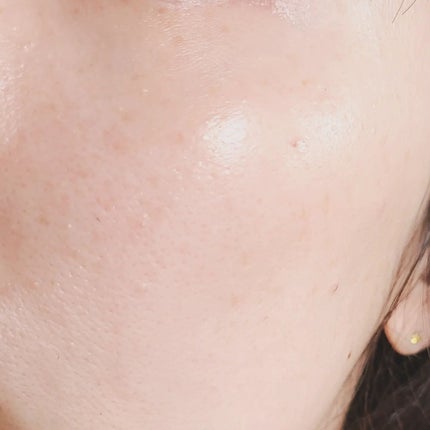 ラグジュアリーEXOステムセラム/demarrer/美容液を使ったクチコミ(9枚目)