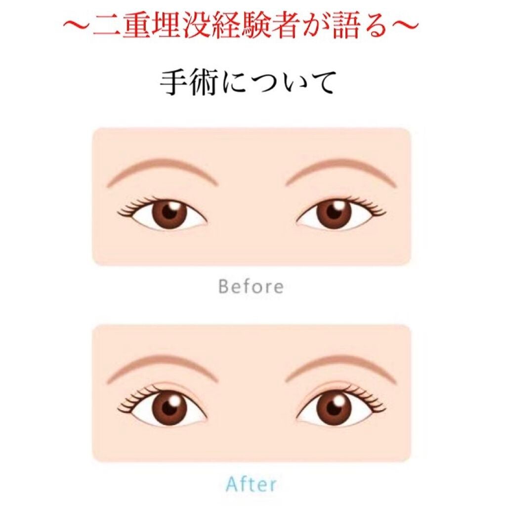 角砂糖 on LIPS 「一重や奥二重にコンプレックスを持っている方多いのではないでしょ..」(1枚目)