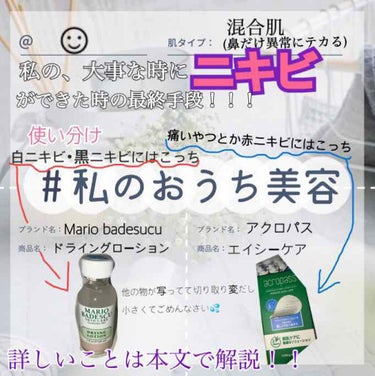 ニキビで困っている人必ず見て！！！ほしい😍



#私のおうち美容 に参加します！！😊

今回紹介するのは、
･ マリオバデスク  ドライングローション
･ アクロパス  エイシーケア
です💜



画