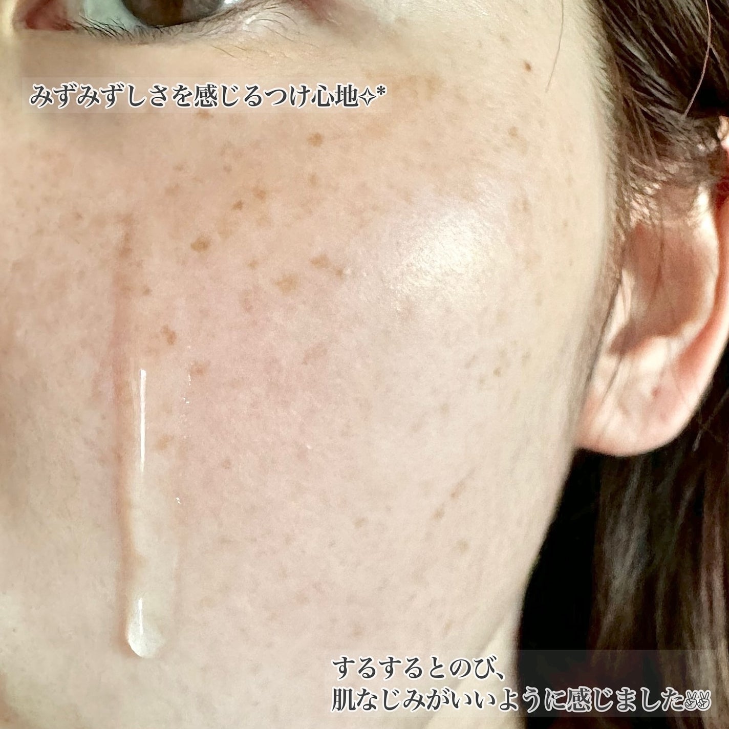 ターンオーバーアンプル/REJURAN COSMETICS/美容液を使ったクチコミ(5枚目)