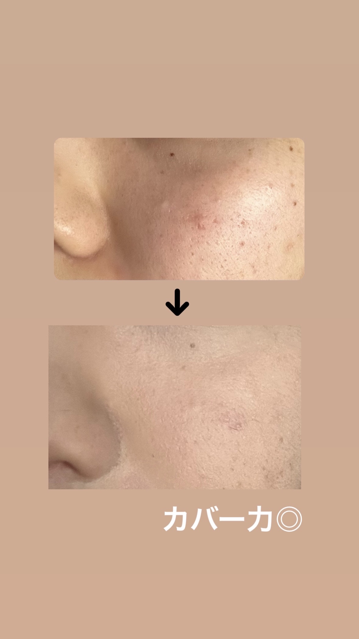 ロングラスティングチップコンシーラー 0.7 アイボリー/LUNA/リキッドコンシーラーを使ったクチコミ（3枚目）