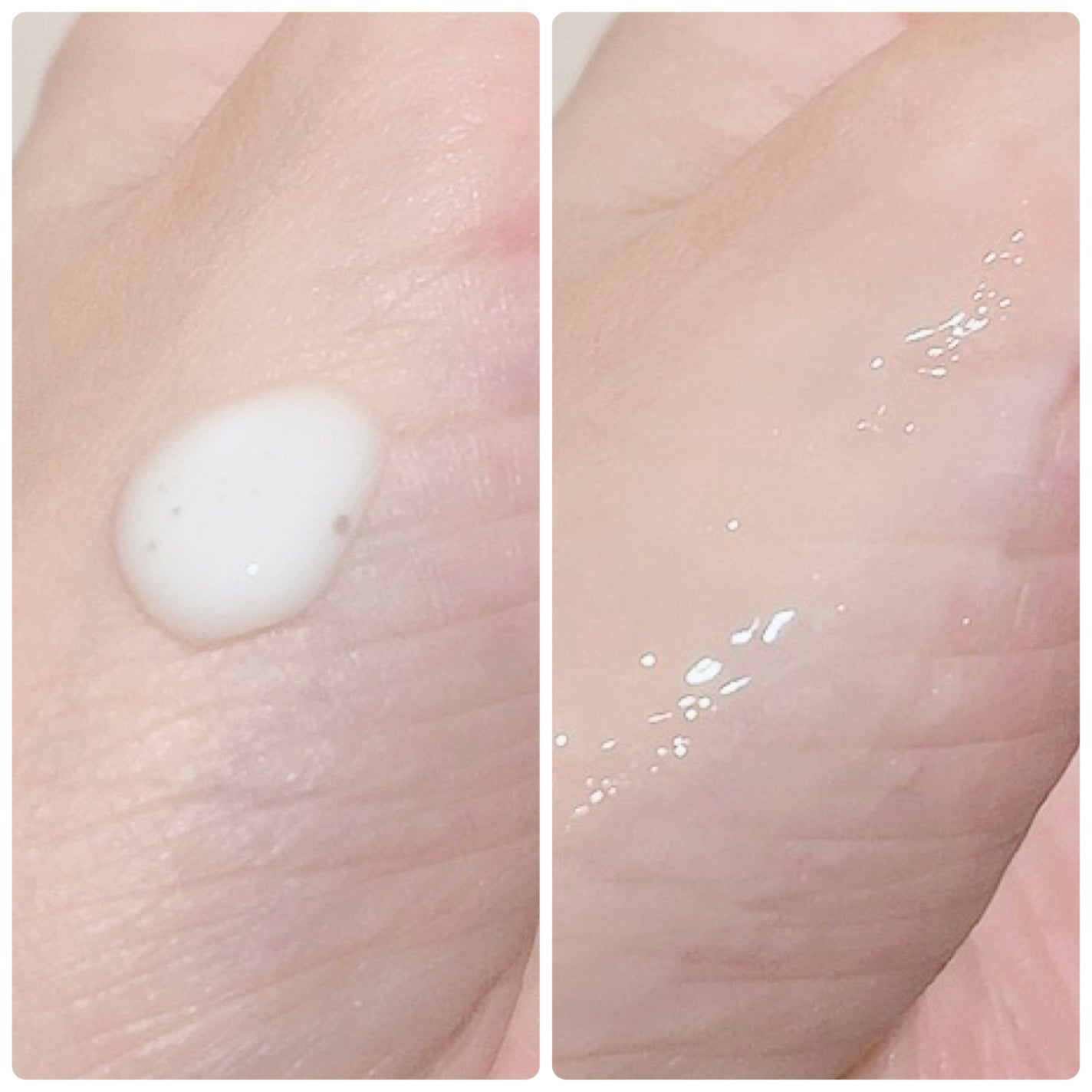 エージプロテオム/エステダム/美容液を使ったクチコミ(4枚目)