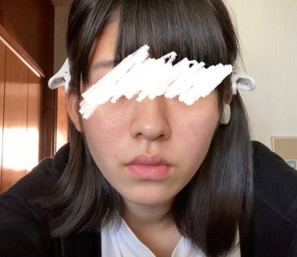 オードムーゲ 薬用ローション(ふきとり化粧水)/オードムーゲ/拭き取り化粧水を使ったクチコミ(4枚目)