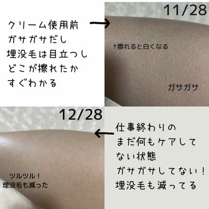 ボラージ クリーム/ちふれ/ボディクリームを使ったクチコミ(2枚目)