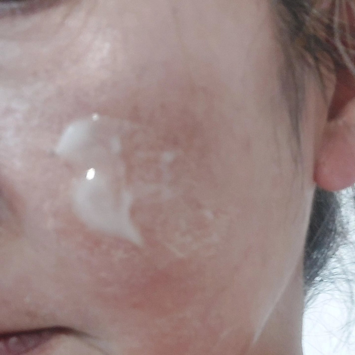 レッドブレミッシュ クリアスージングクリーム/Dr.G/フェイスクリームを使ったクチコミ(5枚目)