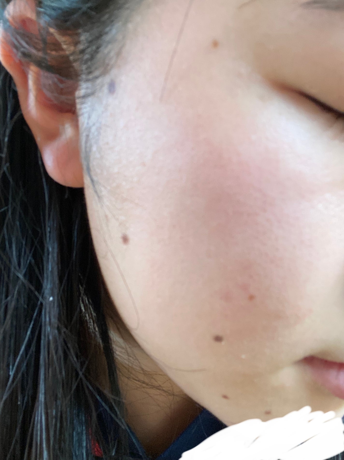 カラミー カラミンノーセバムジェル/Calamee/フェイスクリームを使ったクチコミ(2枚目)