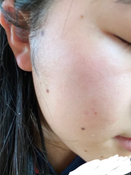 カラミー カラミンノーセバムジェル/Calamee/フェイスクリームを使ったクチコミ(2枚目)