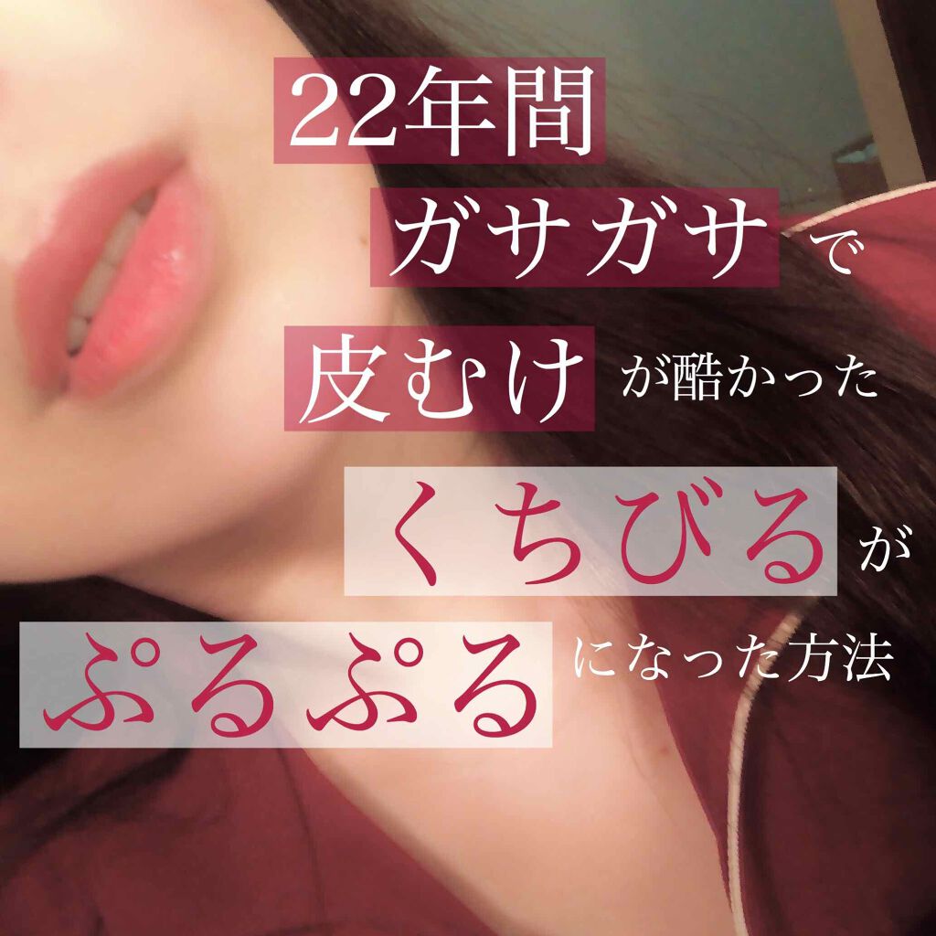 リップ美容液/WHOMEE/リップ美容液を使ったクチコミ（1枚目）