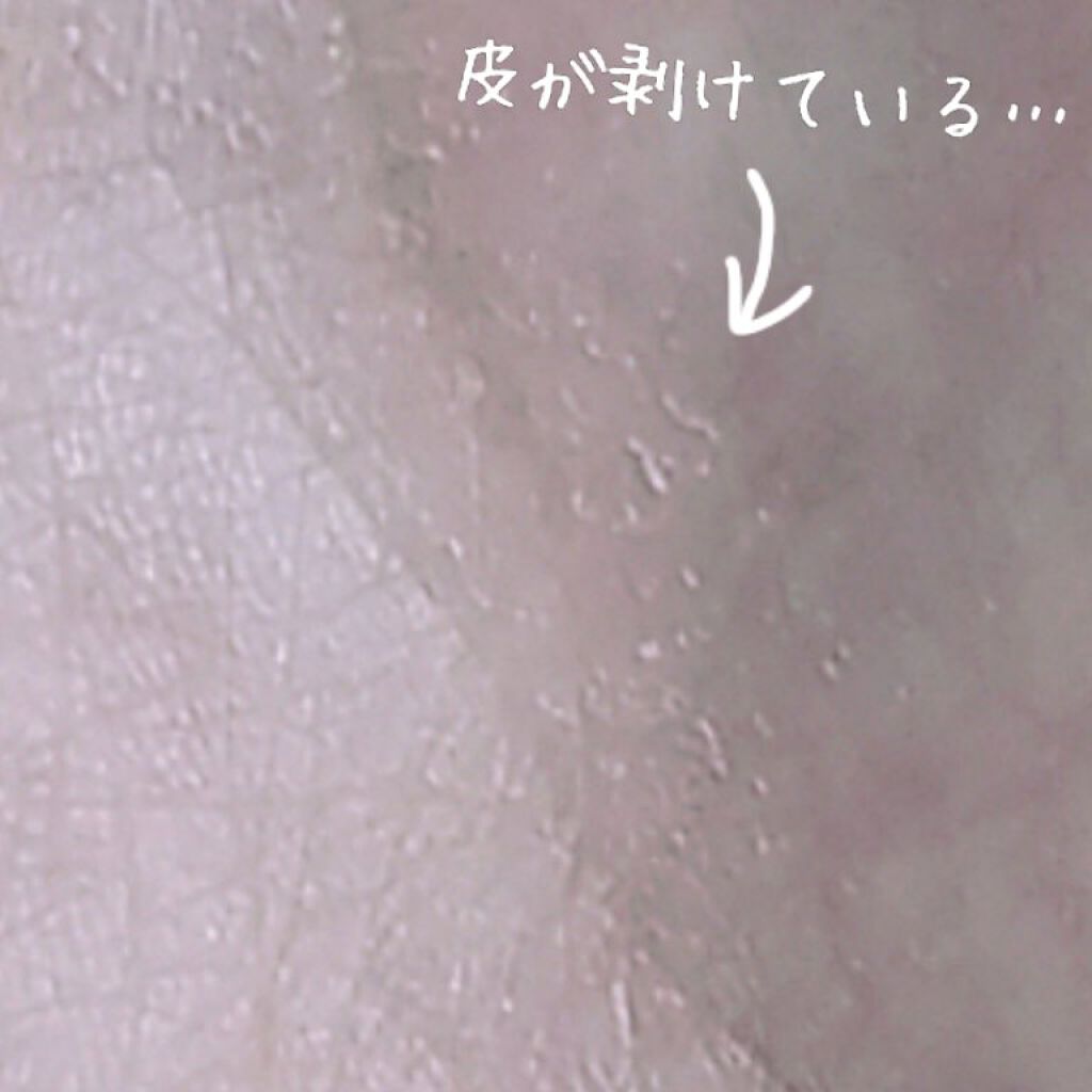 除毛クリームキット(トリートメントEX配合)/エピラット/除毛クリームを使ったクチコミ(4枚目)