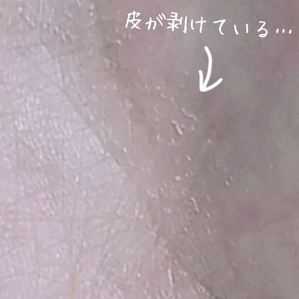 除毛クリームキット(トリートメントEX配合)/エピラット/除毛クリームを使ったクチコミ(4枚目)