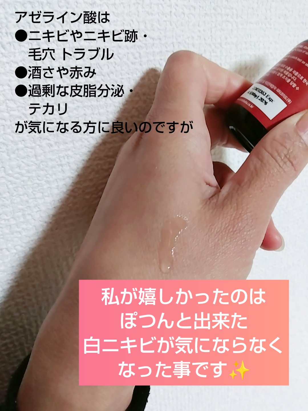 AZアゼライン酸10セラム/コスデバハ/美容液を使ったクチコミ（2枚目）