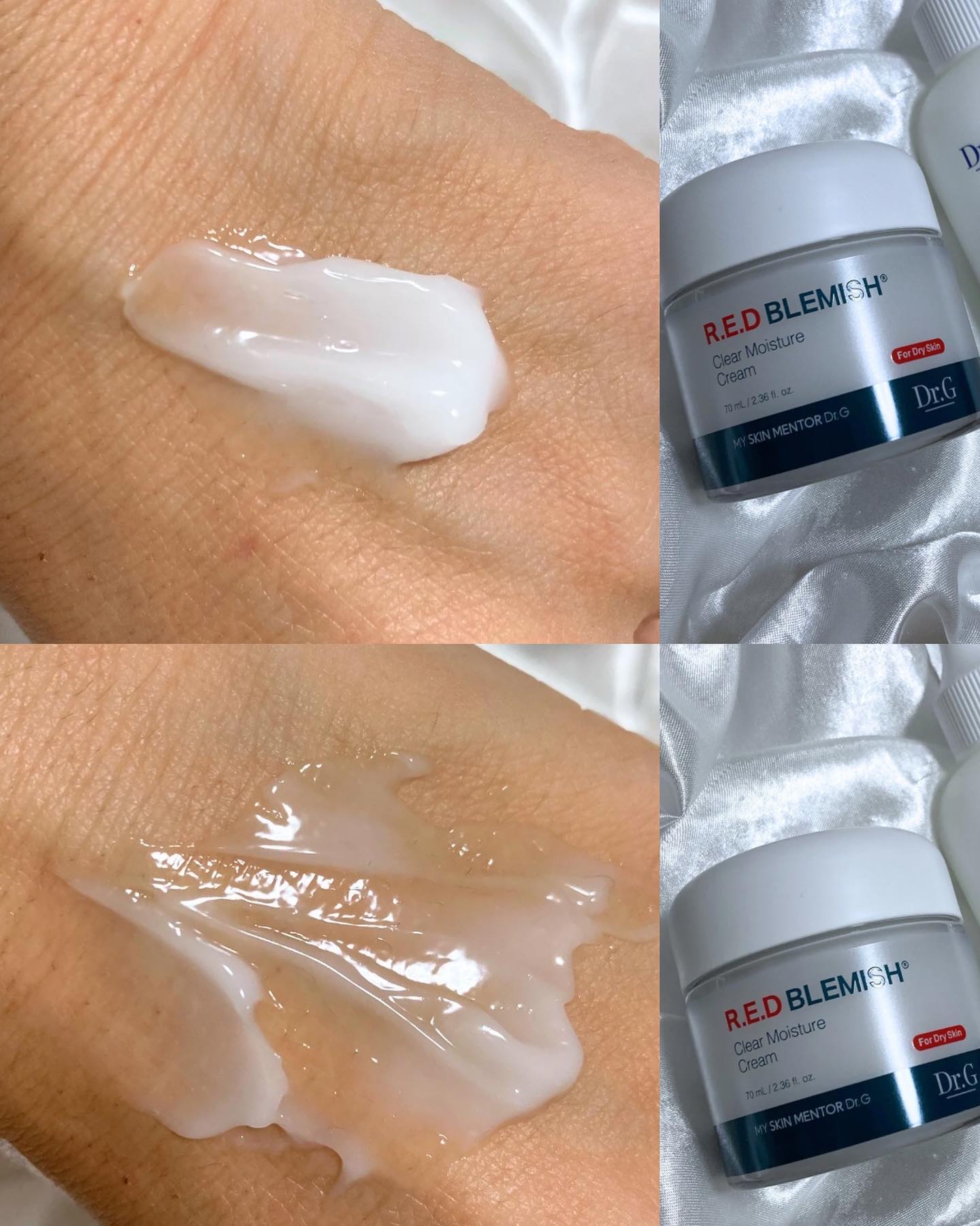 レッドブレミッシュ クリアモイスチャークリーム/Dr.G/フェイスクリームを使ったクチコミ（3枚目）