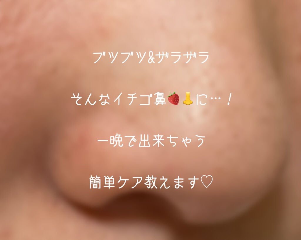 3ステップソクソクノーズパック/MEDIHEAL/シートマスク・パックを使ったクチコミ(1枚目)