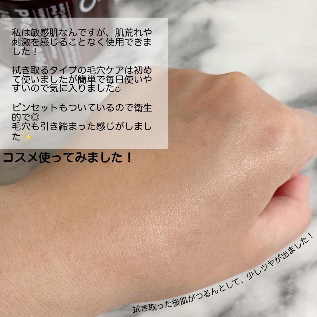 ヘルプミー! ハニーCパッド/One-day's you/トナーパッドを使ったクチコミ(10枚目)