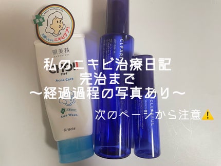 クリアフル ローションM(しっとりタイプ)/オルビス/化粧水を使ったクチコミ(1枚目)