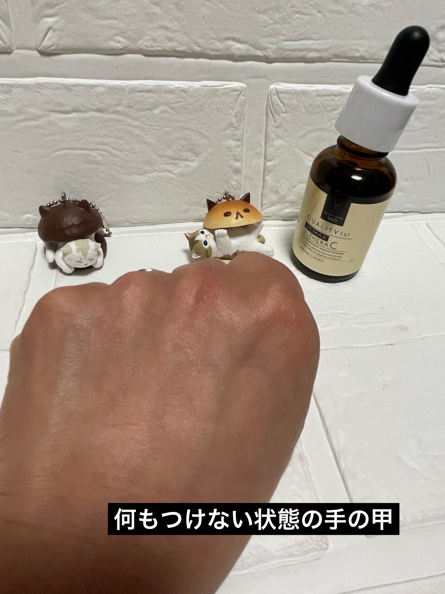 ダーマレーザー ウルセラC/クオリティファースト/美容液を使ったクチコミ(3枚目)