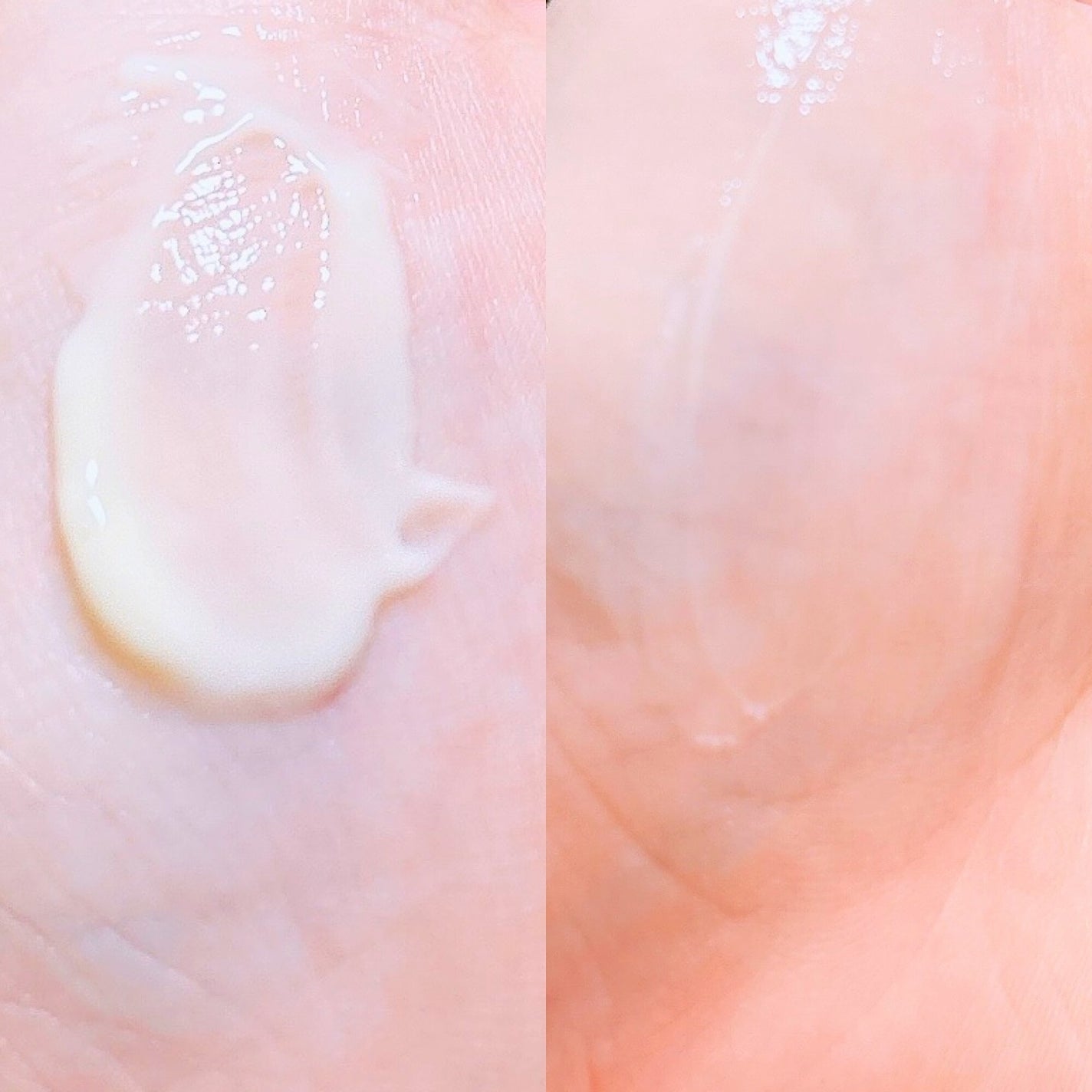 ヴィーガンリポソームレチノールセラム/SKIN&LAB/美容液を使ったクチコミ(3枚目)