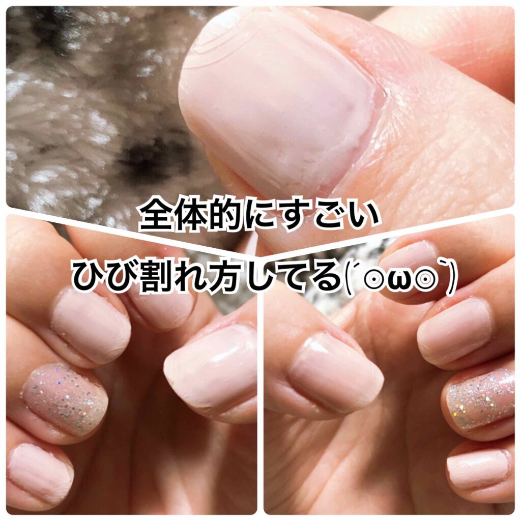 ジェルボリュームトップコート キャンメイクの辛口レビュー 01 241日たった後の写真 By みっちぇ 敏感肌 代後半 Lips