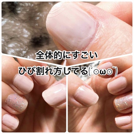 ジェルボリュームトップコート/キャンメイク/ネイルトップコートを使ったクチコミ(4枚目)